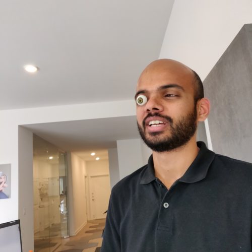 Deepak wearing a glass eye